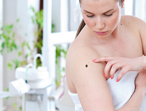 How to Conduct Your Own Skin Cancer Check